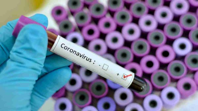Histeria por coronavirus