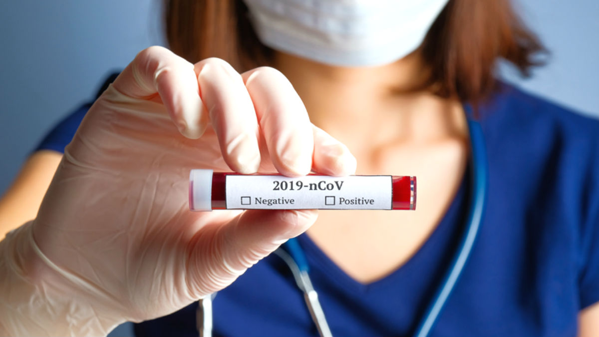 España sufre escasez de test rápidos contra el coronavirus
