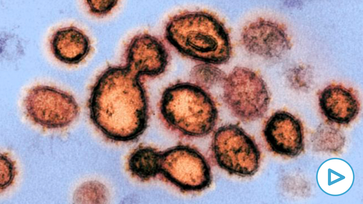 Imagen real del SARS-CoV-2 visto bajo un microscopio.