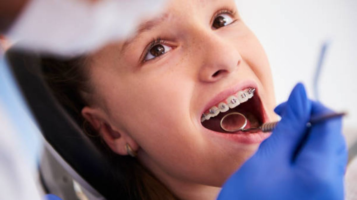 Descubre a qué edad y en qué casos se debe colocar la ortodoncia para niños