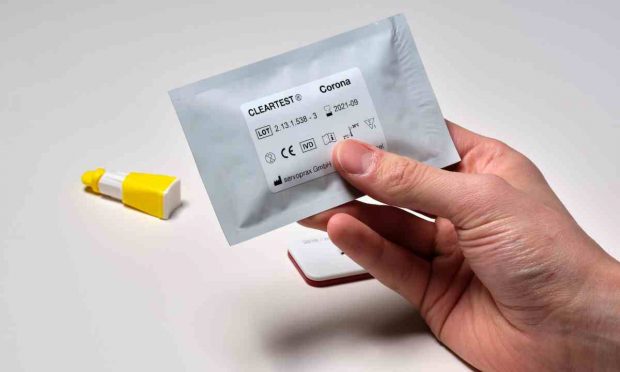 Test y coronavirus