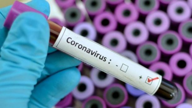 Coronavirus y superficies