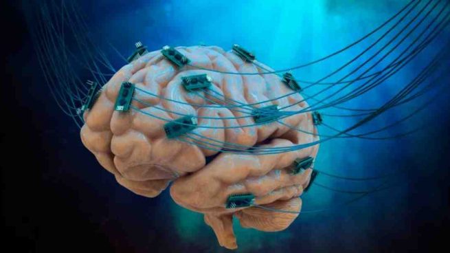 Bacterias en el cerebro humano