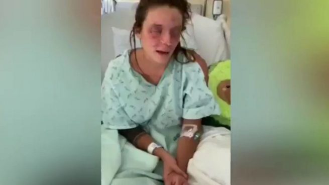 Una joven española residente en Estados Unidos pide ayuda tras perder la vista por un accidente con sosa caústica