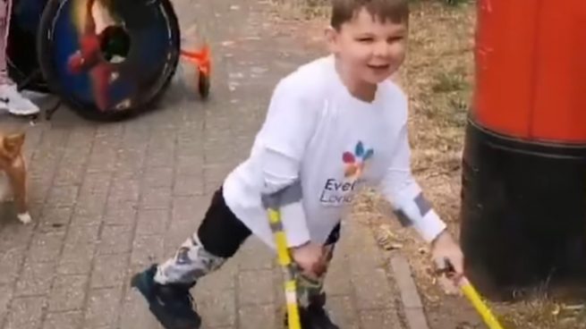 Facebook: Un niño de 5 años con las piernas amputadas por maltrato infantil recauda dinero para los médicos