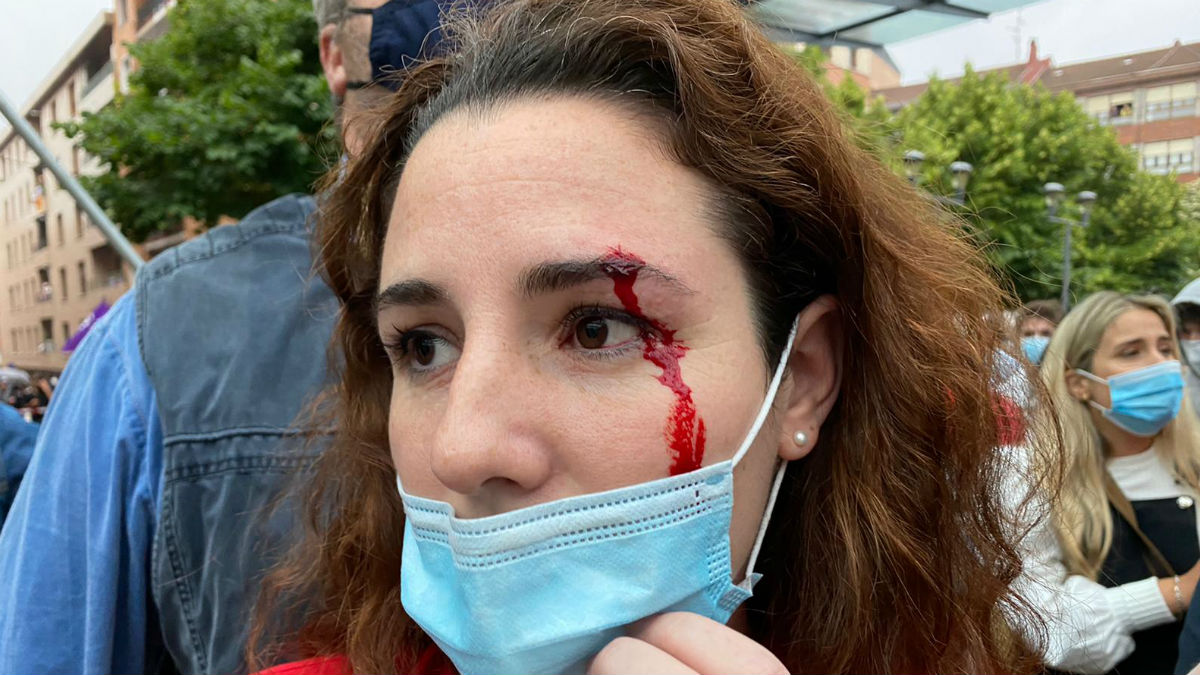 La diputada de Vox Rocío de Meer tras ser agredida por los proetarras en Sestao. (Foto: Vox)
