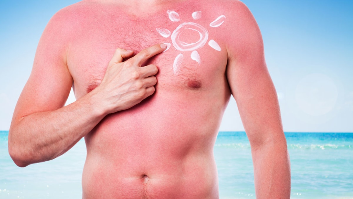 El sol puede provocar graves daños en la piel si no la proteges correctamente