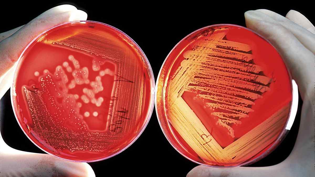 Bacterias analizadas en un procultivo
