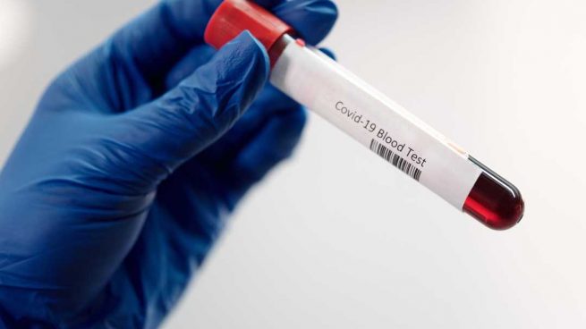 Andalucía registra 1.359 casos y 34 muertes, pero bajan de 1.500 los hospitalizados con coronavirus