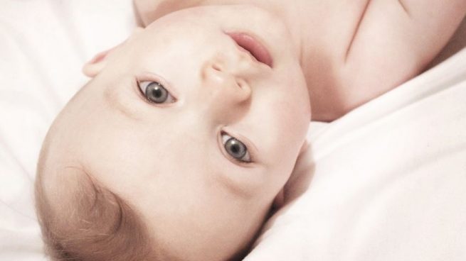 Un 70% de los recién nacidos padece dermatitis seborreica