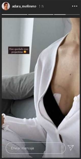 Adara Molinero muestra su pecho en Instagram