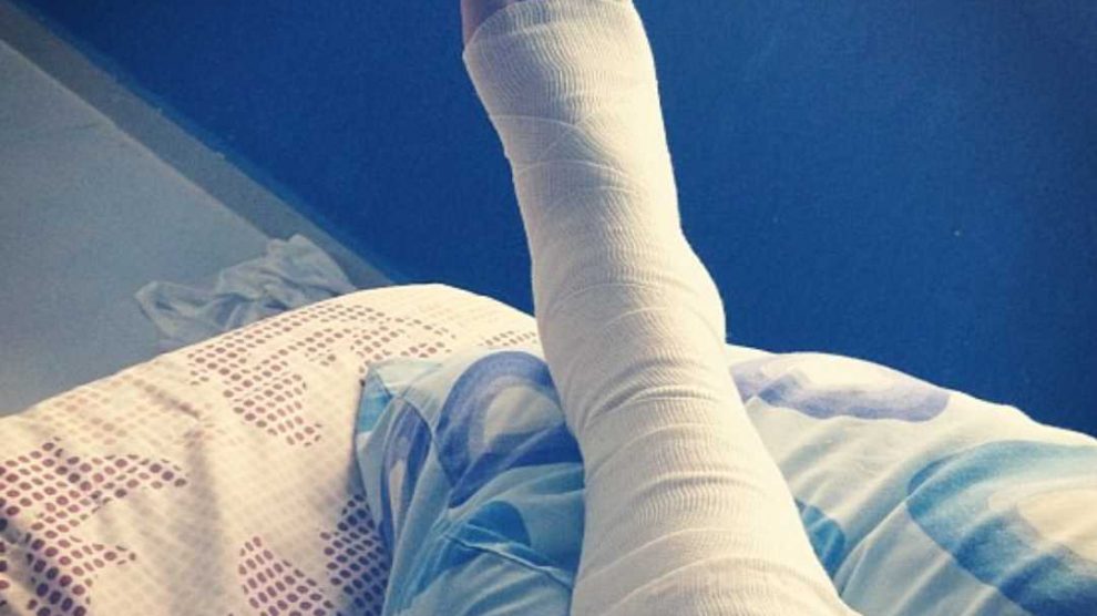 Huesos: Esguince en dedos de los pies