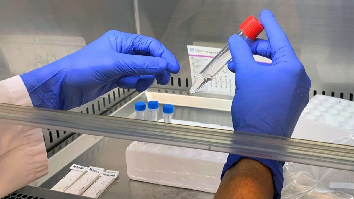 PCR a través de la saliva @Quirónsalud