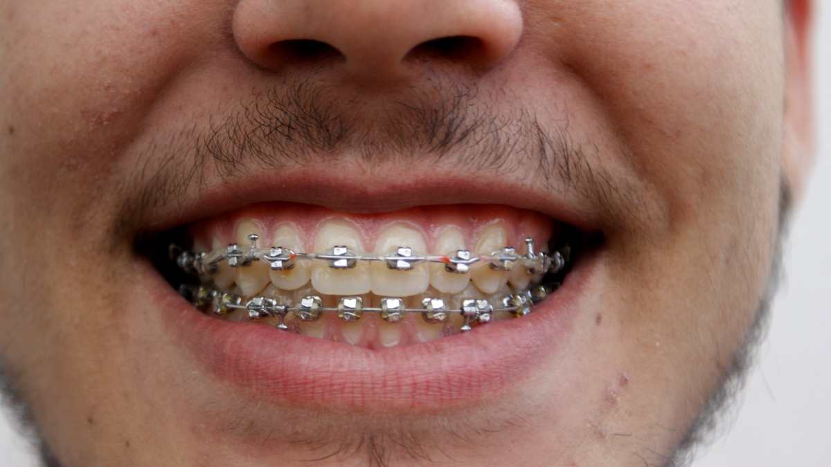 Brackets скобки