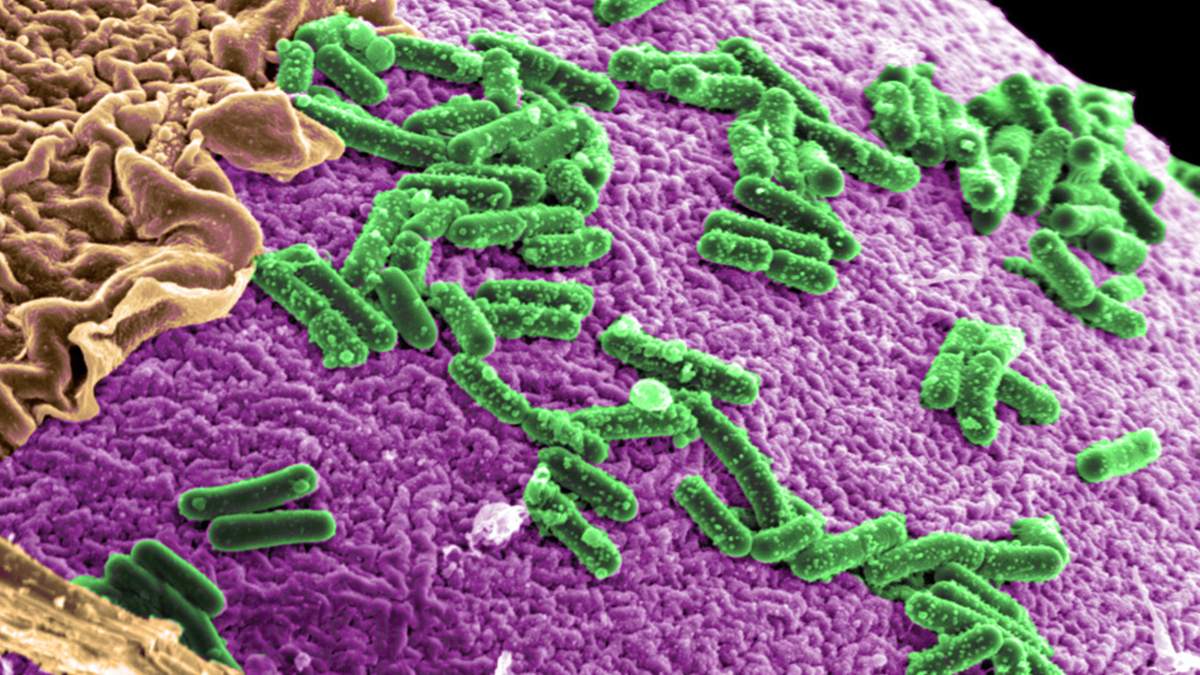 Bacterias intestinales y la pérdida de peso