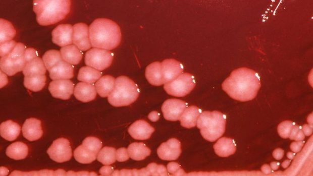 Las personas que han estado graves por coronavirus desarrollan una respuesta inmune más fuerte