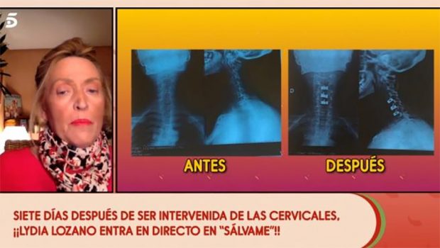 Lydia Lozano muestra sus radiografías en Sálvame