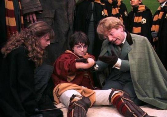 Harry Potter en la escena con el brazo protésico