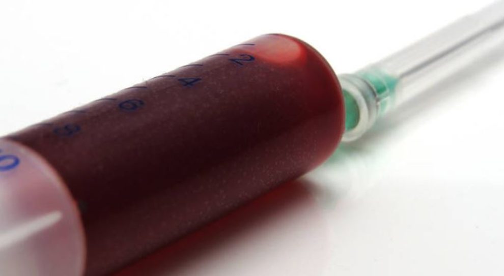 ¿Qué grupo sanguíneo es más propenso a infectarse de Covid?