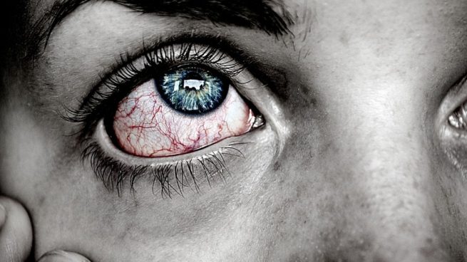 El ojo seco, un problema que aumenta con la pandemia