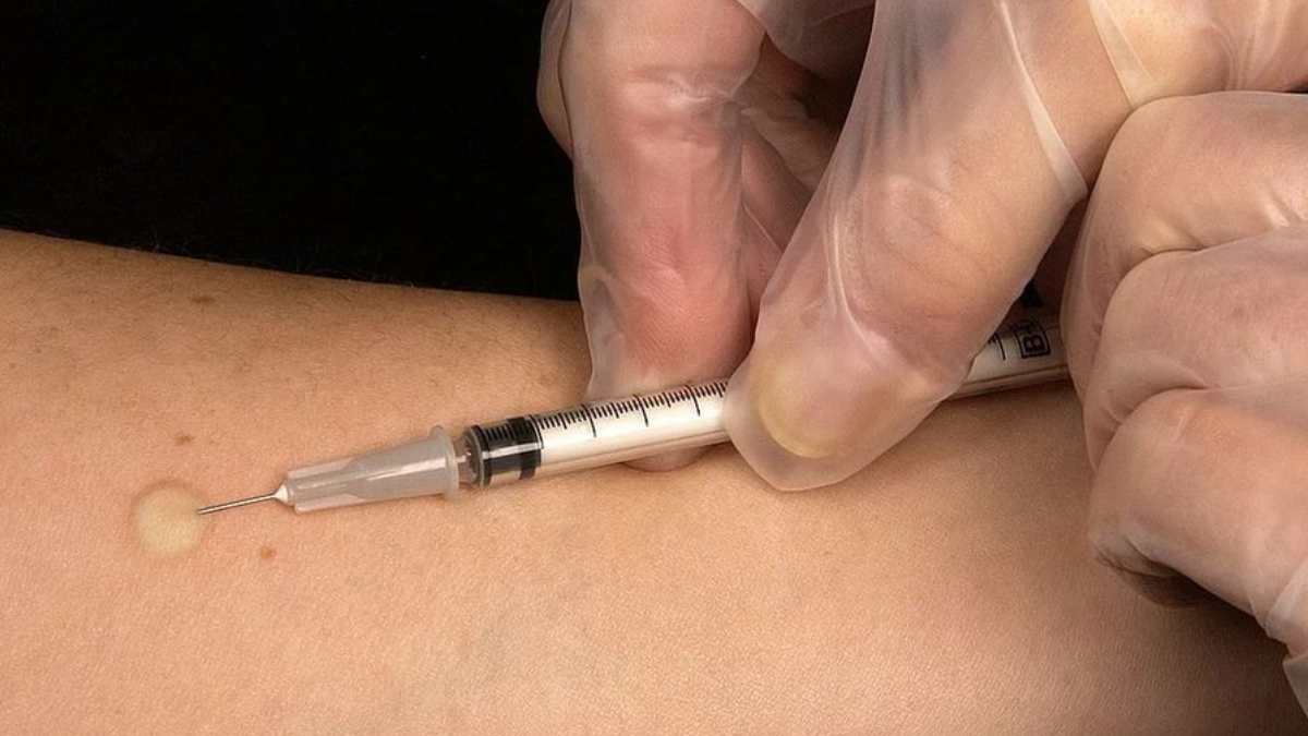 Una vacuna española contra la tuberculosis será probada su eficacia en África.
