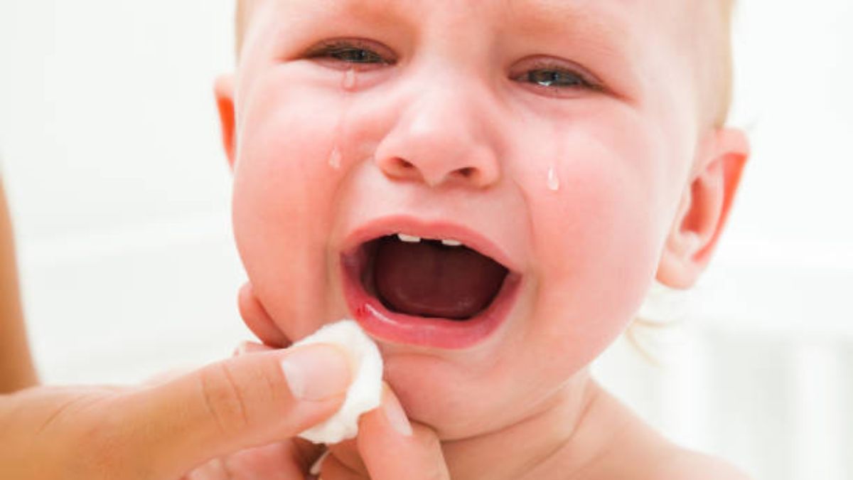 Herpes Labial En El Bebe Causas Sintomas Y Riesgos