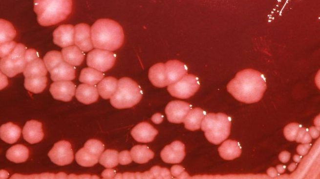¿Qué es el peligroso hongo negro que está afectando a pacientes de Covid-19 en diversos países?
