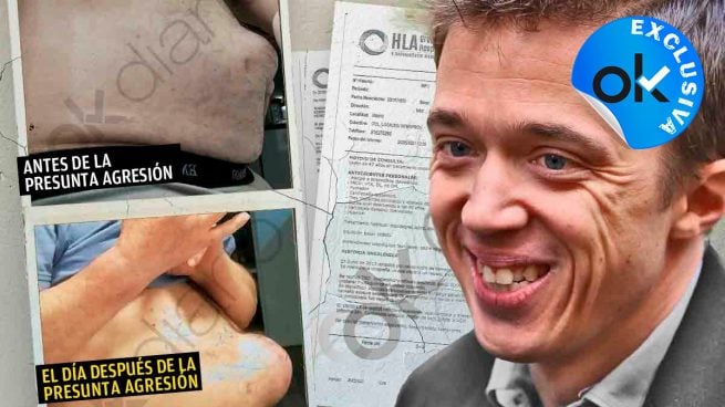 Así quedó el vecino de Lavapiés que ha denunciado a Íñigo Errejón por agredirle