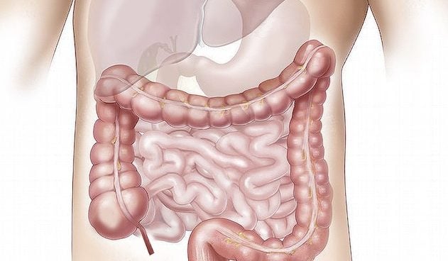 Desarrollan un probiótico que previene y trata la obesidad