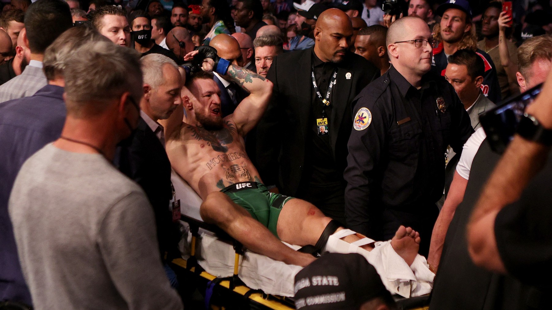 McGregor, tras la lesión. (AFP)