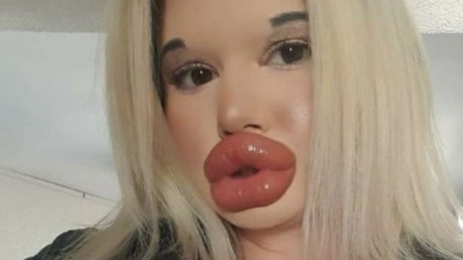 Mujer labios más grandes del mundo