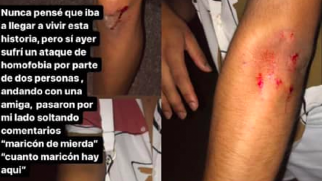 Un joven denuncia haber sido agredido en Granada al grito de «¡cuánto maricón hay aquí!»