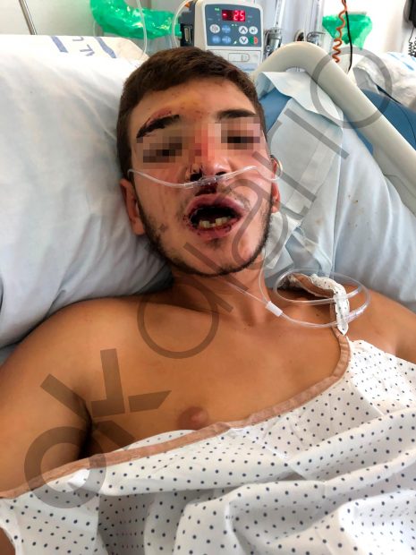 El padre del menor apuñalado y agredido por inmigrantes en Ceuta: «Aún hoy sigue sangrando»