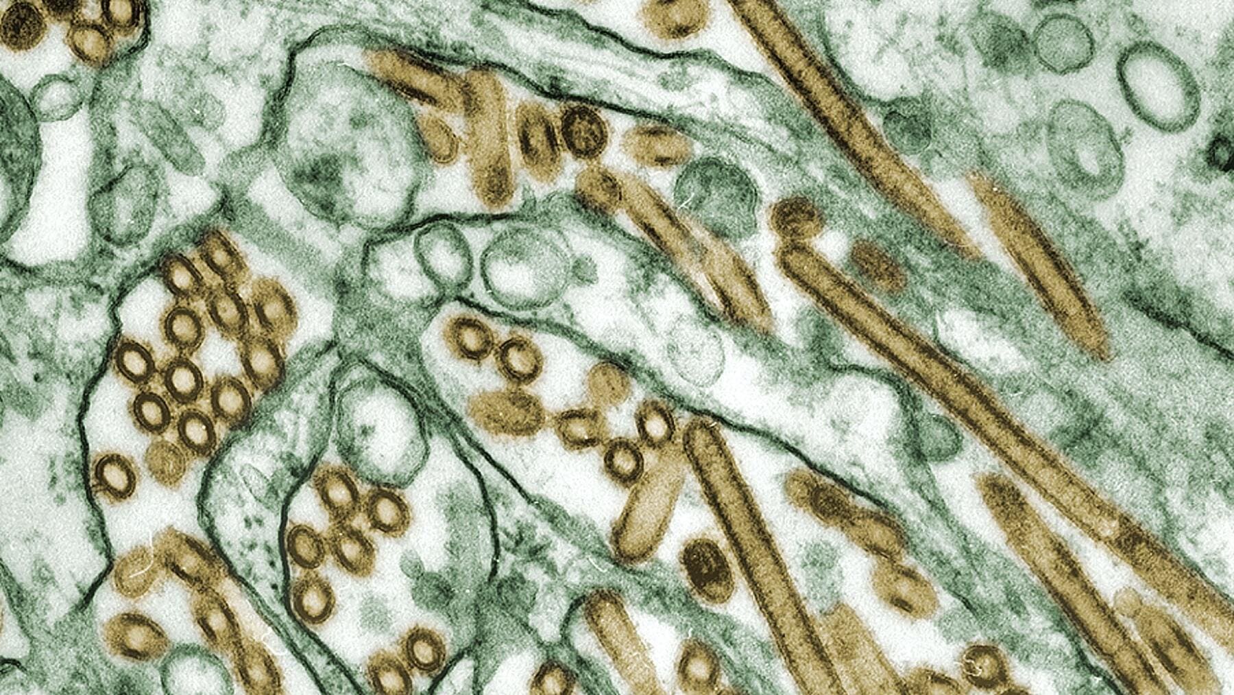 Virus