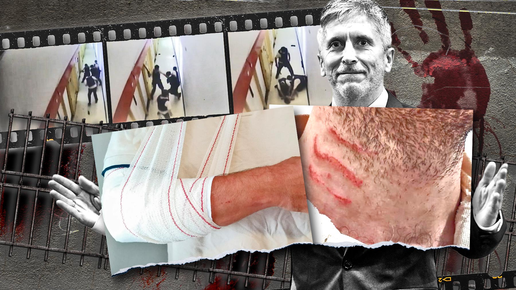 Imágenes del vídeo filtrado por Interior y las lesiones de los funcionarios que redujeron al preso de Villena.