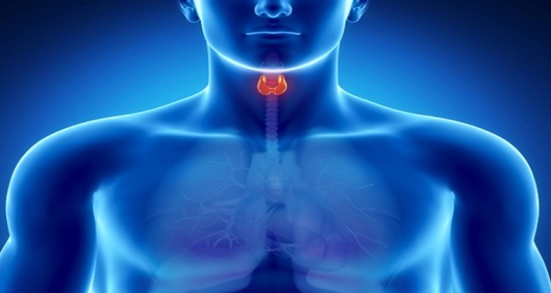 El carcinoma papilar representa el 80% de los casos  de cáncer de tiroides.