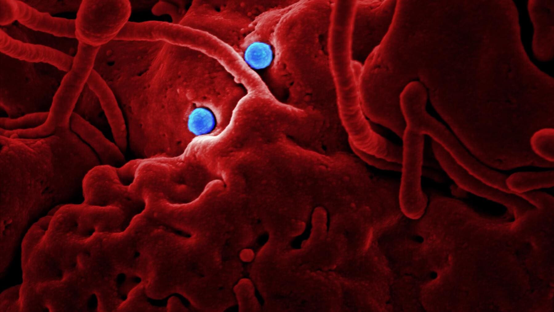 Virus