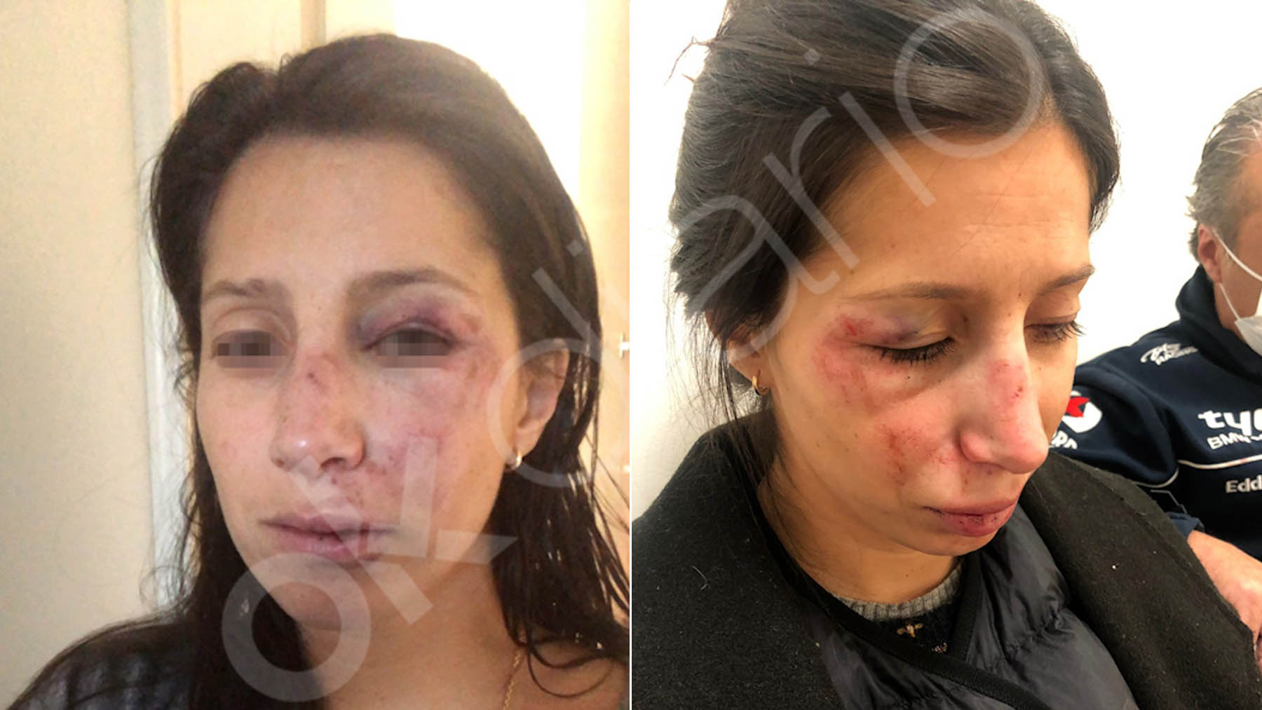 Imágenes de la mujer agredida en Vitoria por cuatro menas.