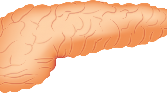 Día Mundial del Cáncer de Páncreas 2021: ¿existen factores de riesgo? ¿Cuáles son?