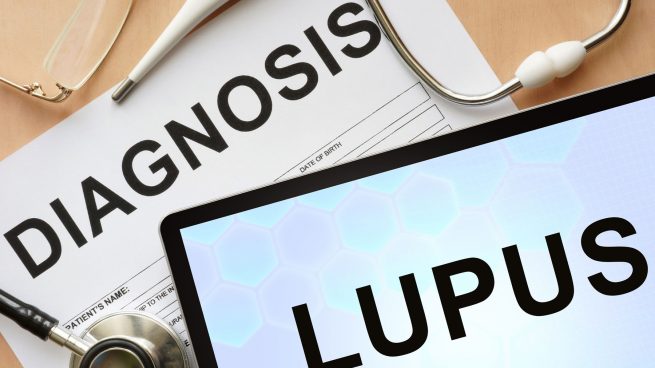 España contará con el primer registro de lupus pediátrico