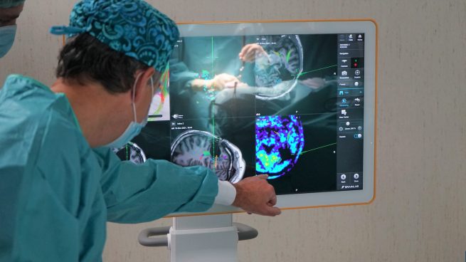 Una nueva plataforma de navegación quirúrgica localiza lesiones cerebrales de forma más precisa