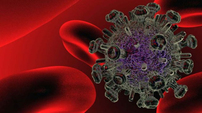 Virus del SIDA VIH