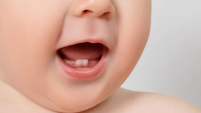 caries dientes de leche