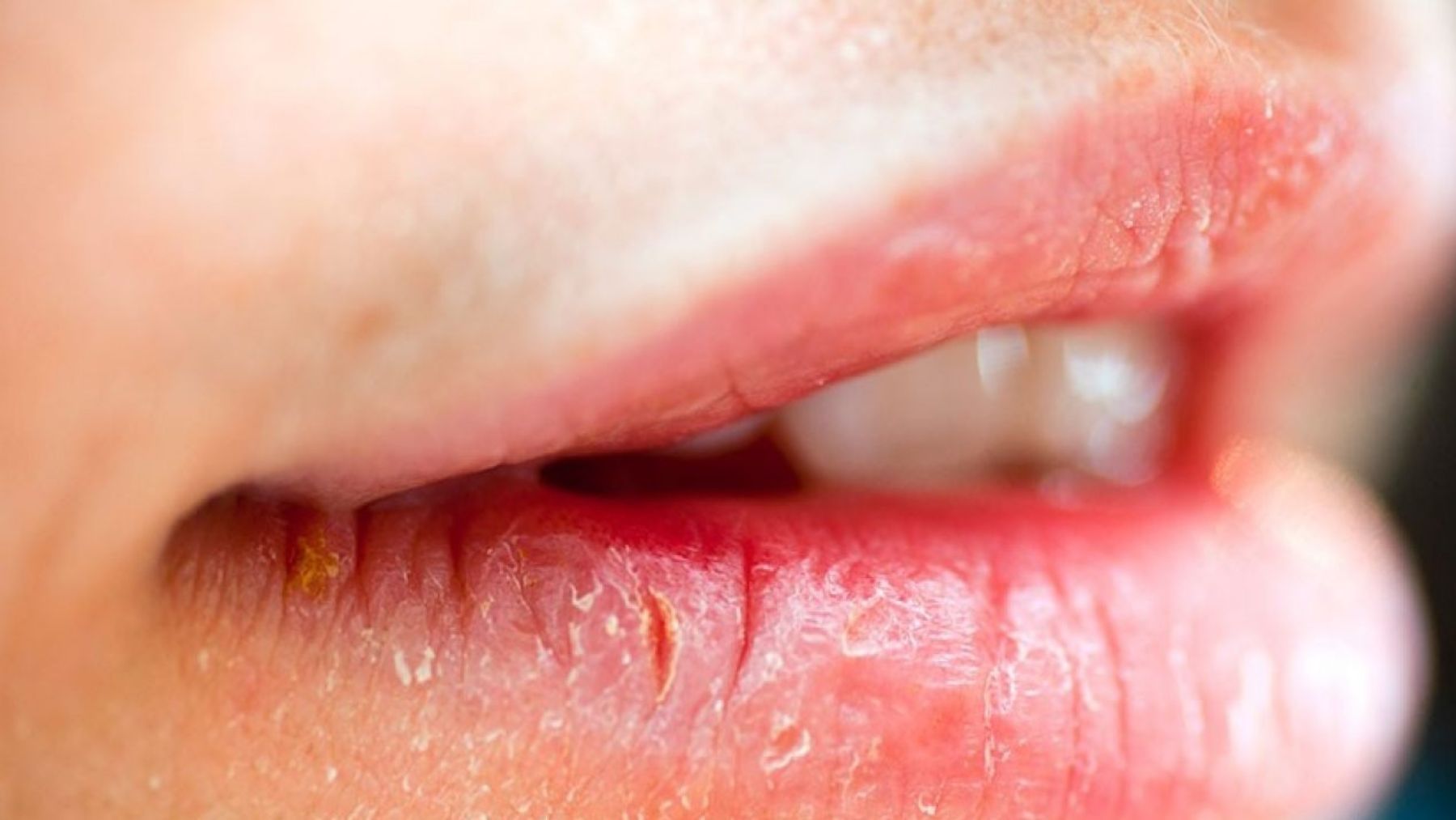 Descubre el mejor ingrediente para hidratar tus labios