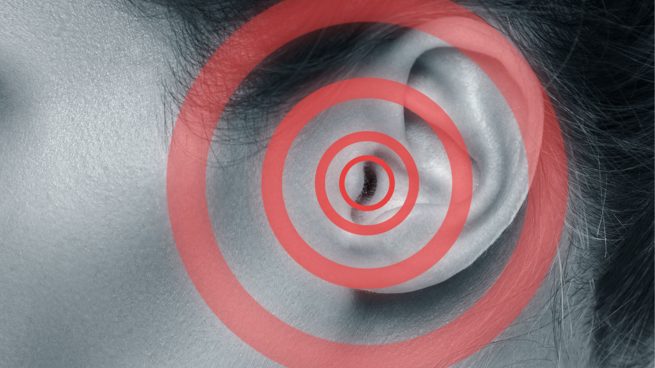 El tinnitus constante altera la actividad del cerebro