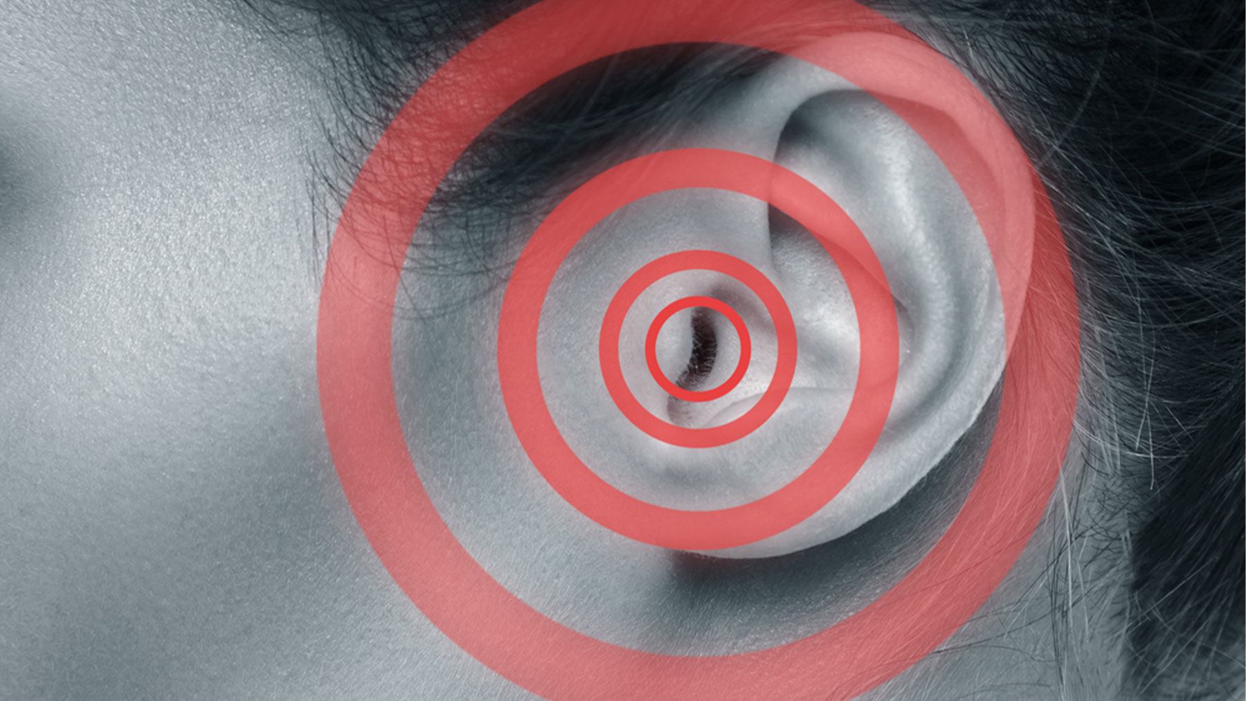 El tinnitus (acúfenos), que se caracteriza por molestos pitidos o zumbido en los oídos.