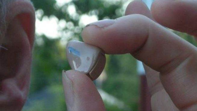 Los implantes cocleares mejoran la calidad de vida y la salud mental, según un estudio