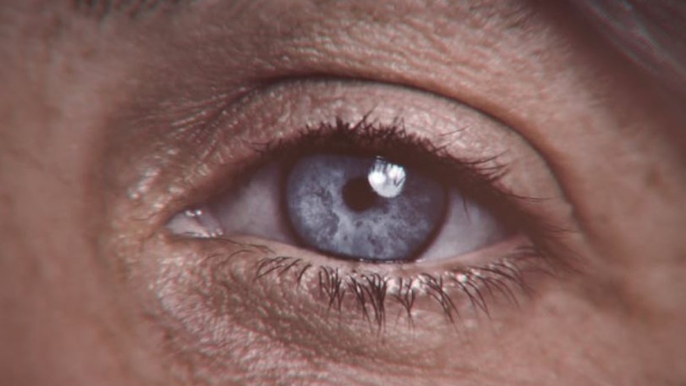 Día mundial del glaucoma 2022: más de un millón de personas afectadas