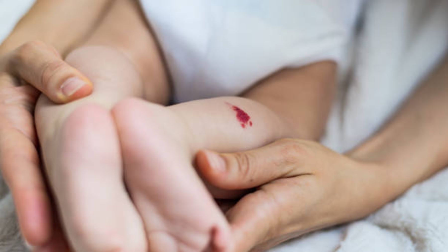 En qué fijarse para detectar hemangiomas en la piel del bebé