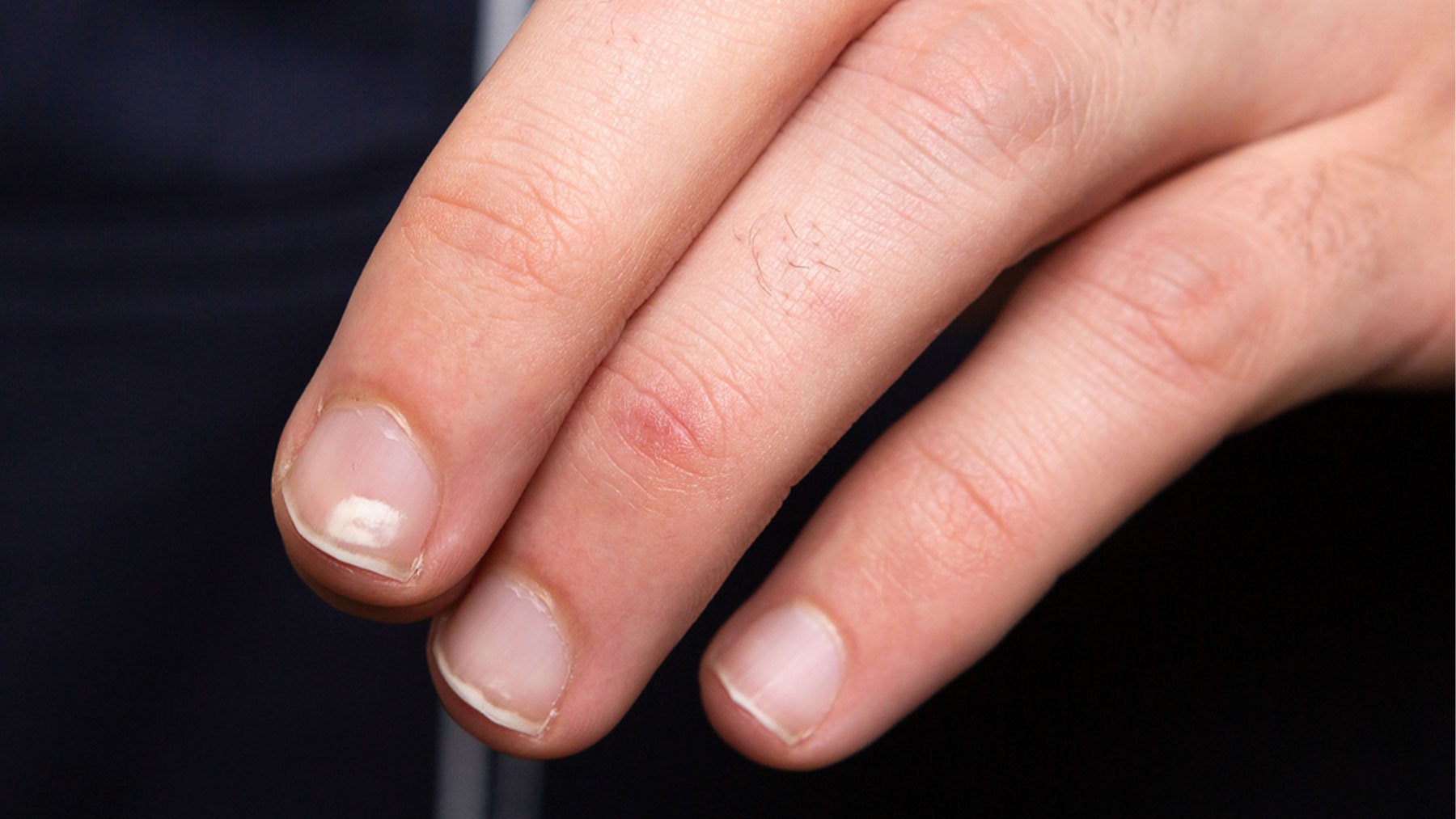 Unas uñas saludables tienen que ser lisas, sin marcas y de color rosado.